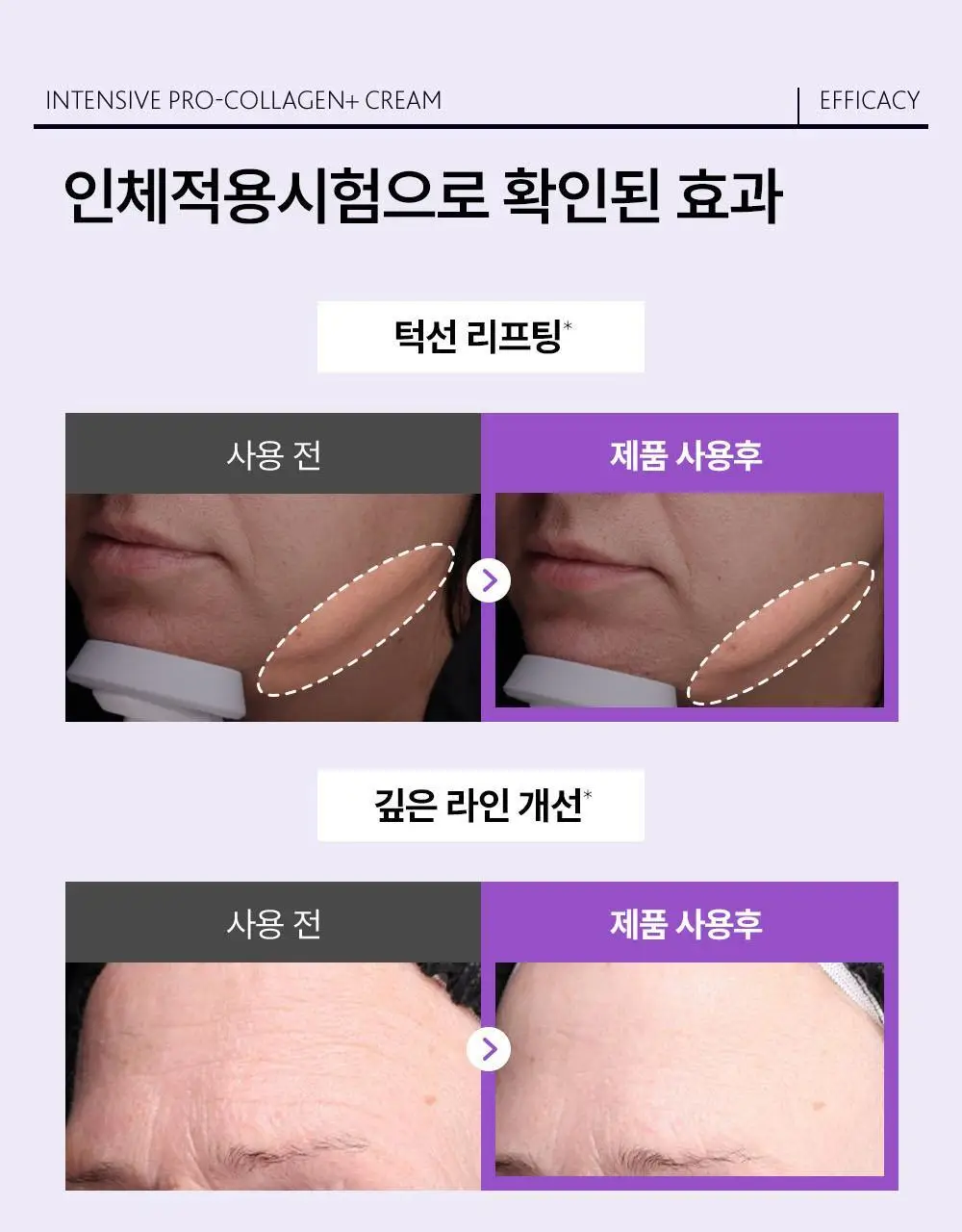 [패키지 리뉴얼]에스테덤 인텐시브 프로 콜라겐+ 크림 50ml 상세페이지 18